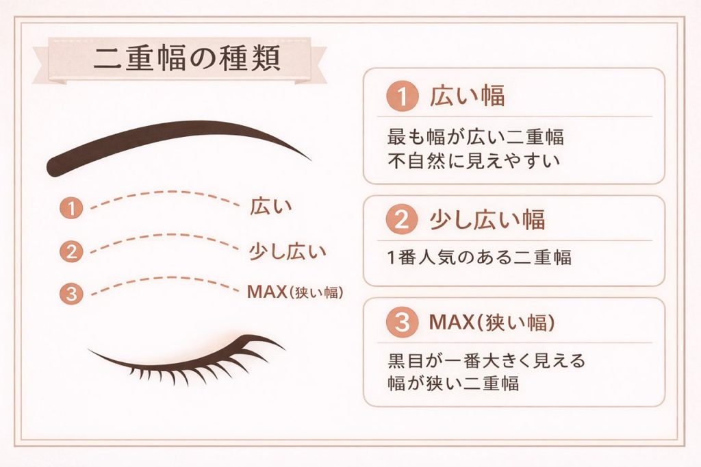 水の森美容クリニックの二重幅解説。広い幅、少し広い幅、MAX(狭い幅)の3種類の違い
